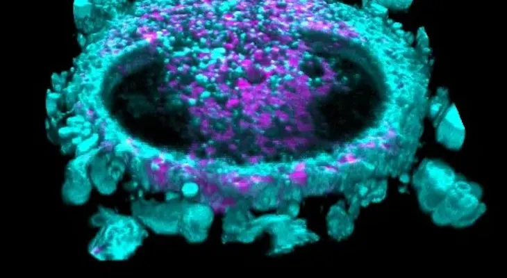 Células cancerígenas responden a compresión con un "chute de energía"