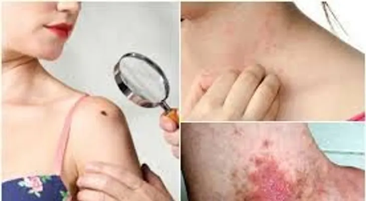 Señales de que tiene un cáncer: Presta mucha ATENCION 