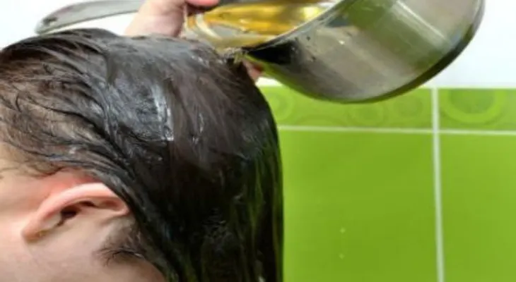 El más efectivo tratamiento anti-calvicie: Después de 2 días, tu pelo crecerá como loco y de forma natural 