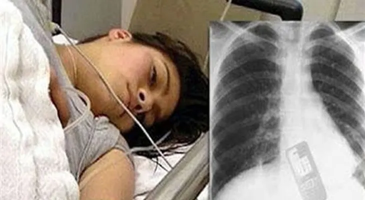 Joven se traga celular para que novio no leyera sus mensajes 