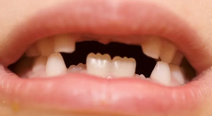 Consejos sencillos para unos dientes sanos en los niños
