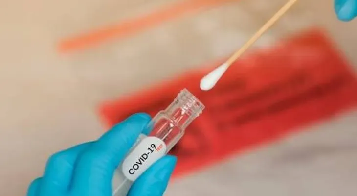 Pacientes dominicanos en cuidados intensivos por coronavirus, han logrado mejoría con Tocilizumab (Actemra) 