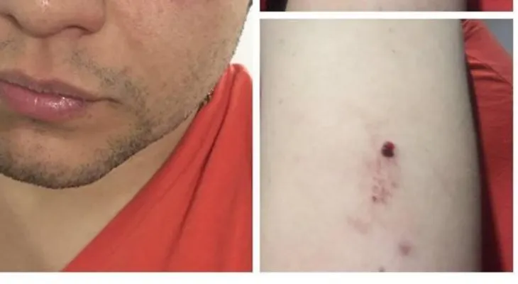 Apuñalan en un brazo al cantante Luifer Cuello para robarle