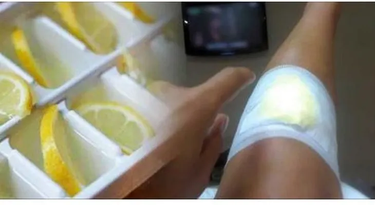 Pon un limón de esta manera en tus rodillas y termina con el dolor definitivamente