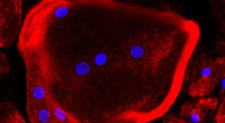 Encuentran la clave para prevenir la metástasis del cáncer de mama