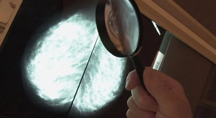 Cáncer será diagnosticado con teléfonos inteligentes