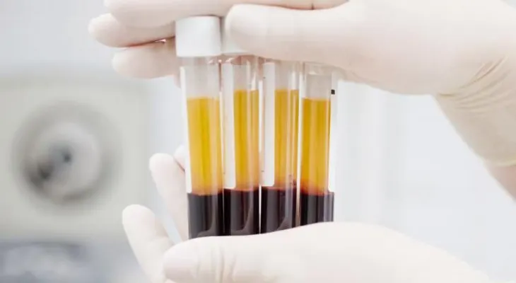 Hallan un biomarcador que permite predecir el cáncer de riñón