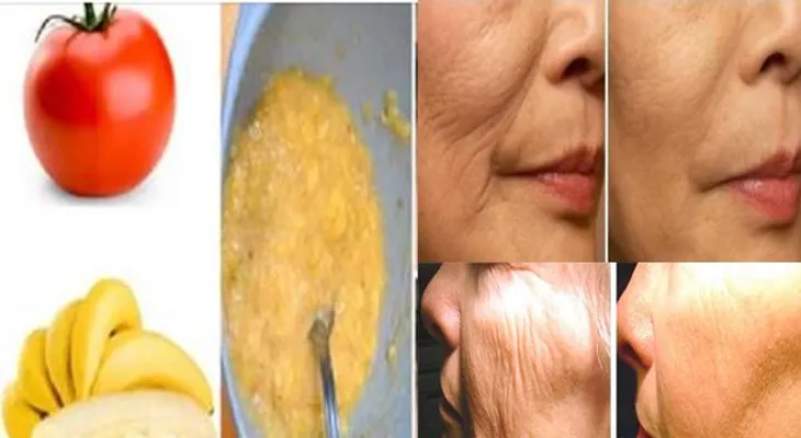 Diga adiós a la arruga facial en sólo 3 días con este remedio casero!