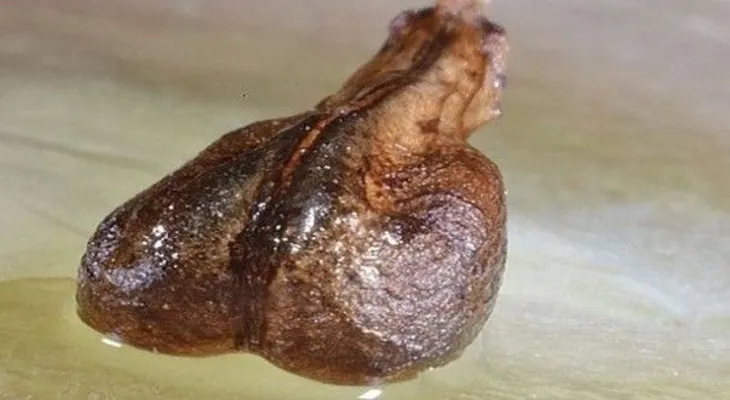 ¿Por qué ocultaron esto tanto tiempo? Científicos encuentran semilla que cura el cáncer