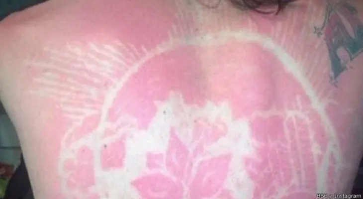 La peligrosa moda de los tatuajes que alarma a los dermatólogos