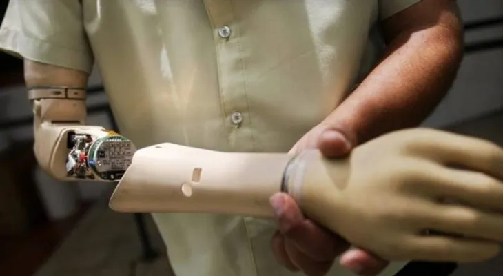  Crean método para restaurar sensación en pacientes amputados 