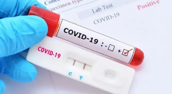 Gobierno y farmacias colaboran para liberar venta de pruebas Covid
