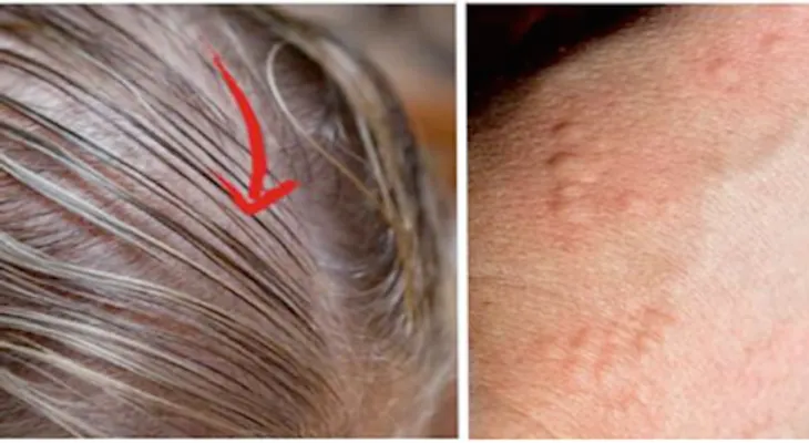 8 señales que indican que sufres de la tiroides