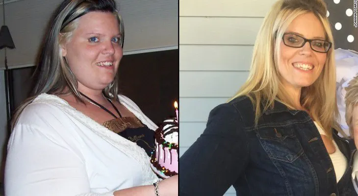 Ella perdió casi 85 kilos para luchar por tener un 'corazón de guerrera'