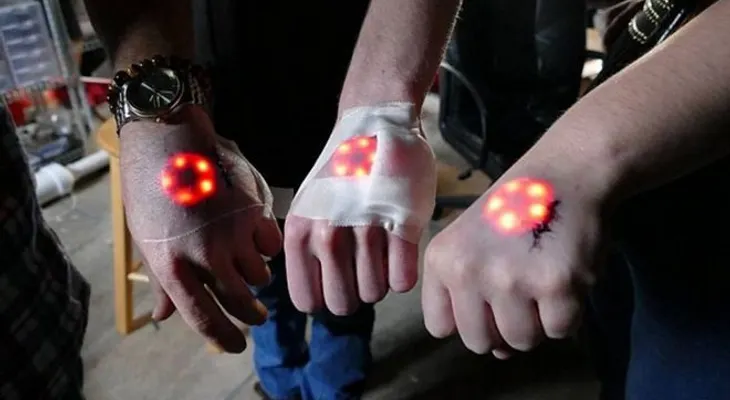 Última Moda. Implantes de luces LED