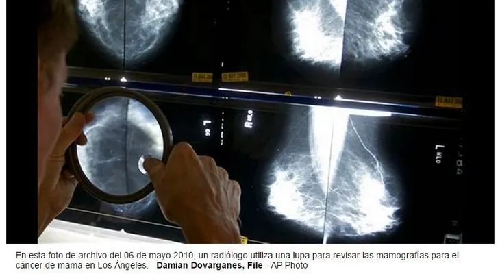Estudio muestra ventaja de tratamiento para cáncer de mama 
