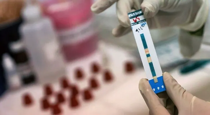 El VIH se podrá prevenir con una vacuna y un implante subcutáneo 