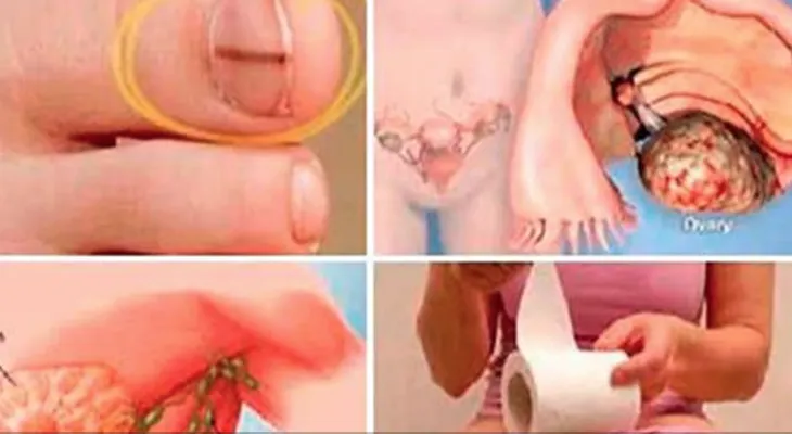 Las 13 señales que te avisan de un cáncer