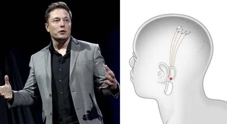 No paran de hablar acerca del chip que conecta el cerebro con un ordenador