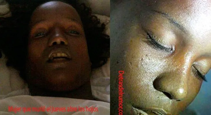 Mujer que murió el jueves suda y abre los ojos dentro de ataud