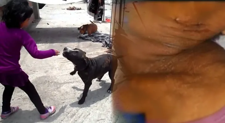  Perro Pit bull mata a dueña en Boca Chica 