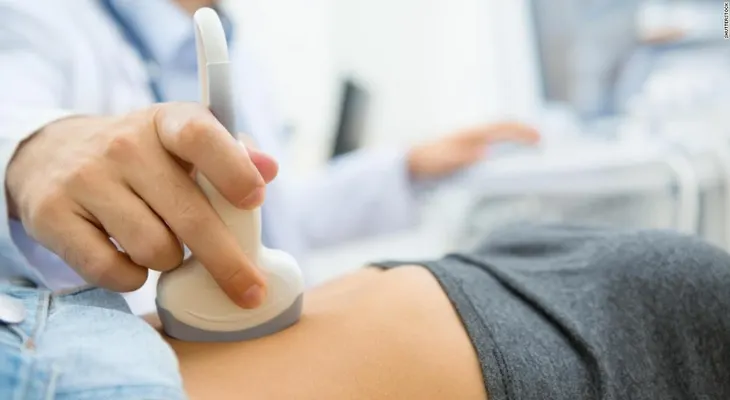 Iowa aprueba la prohibición del aborto más restrictiva de EE.UU.