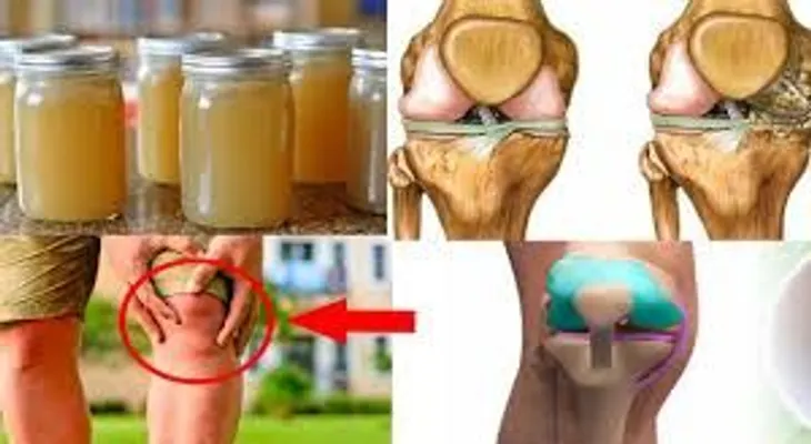 Poderoso remedio para el dolor de rodillas, huesos y articulaciones