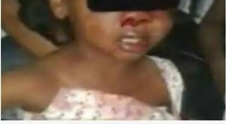 Someterán a la Justicia hombre que ocasionó graves lesiones a una niña durante asalto a su padre