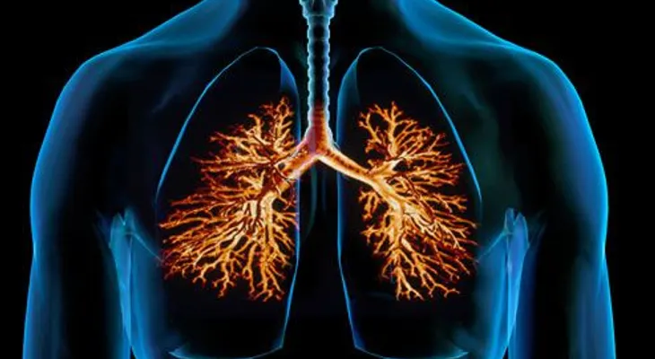 Hallan una vacuna contra la bronquiolitis y la neumonía 