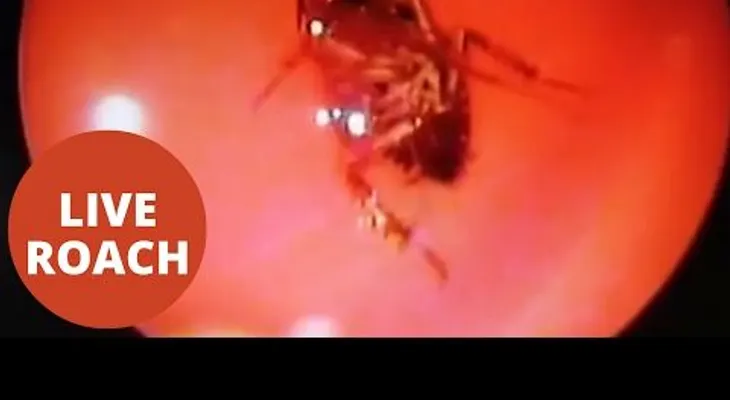 FUERTE VIDEO: Extraen una cucaracha viva de la cabeza de una mujer
