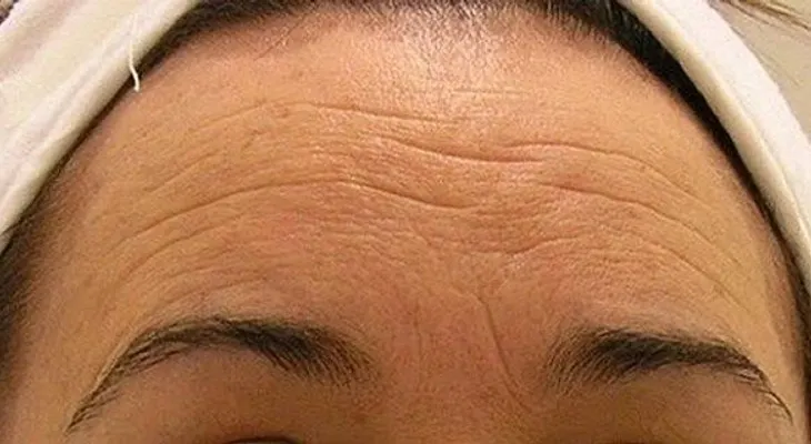 Crema casera para eliminar arrugas en solo 7 días: ¡A lucir más joven y bella!