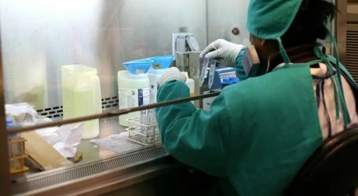 Argentinos crean prueba para detectar tuberculosis