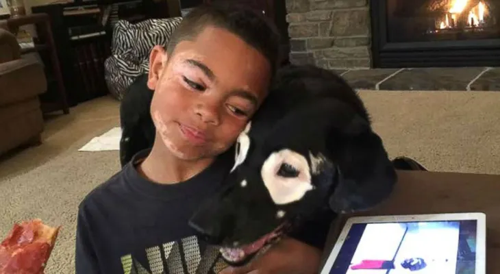 La entristecida historia de un niño con vitiligo que viajó a conocer a un perro con su misma condición