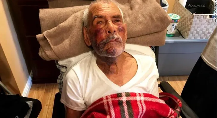Hombre de 91 años atacado con un ladrillo pide a Dios que perdone a su agresora