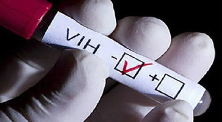 Científicos optimistas en hallar la cura del VIH gracias a nuevas investigacion