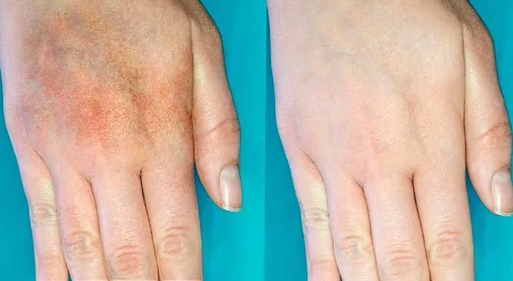 Esta crema hace temblar industria de los cosméticos, elimina las manchas como por magia