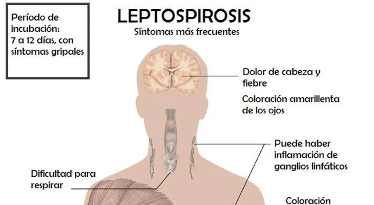 Al menos 53 muertos por leptospirosis en lo que va de año y 626 afectados