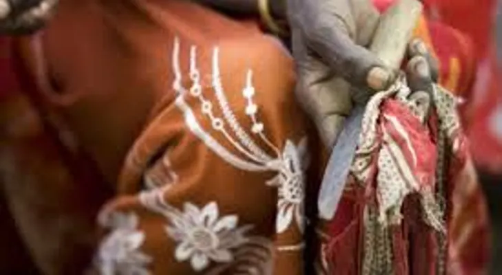 Dos hermanas de 10 y 11 años mueren tras someterse a mutilación genital femenina en Somalia