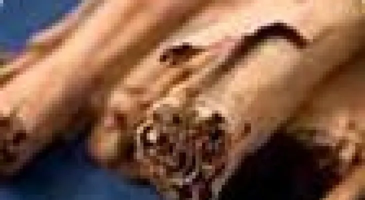 Aceite esencial de canela para piojos, sarnas, verrugas, reumatismo, estrés y otros casos