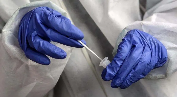 Más de medio millón de casos confirmados de Covid-19 en el mundo en un día