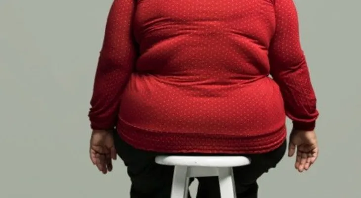 La genética es el factor más importante en la obesidad