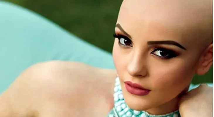 La modelo mexicana que convirtió su lucha contra el cáncer en una fuente de inspiración