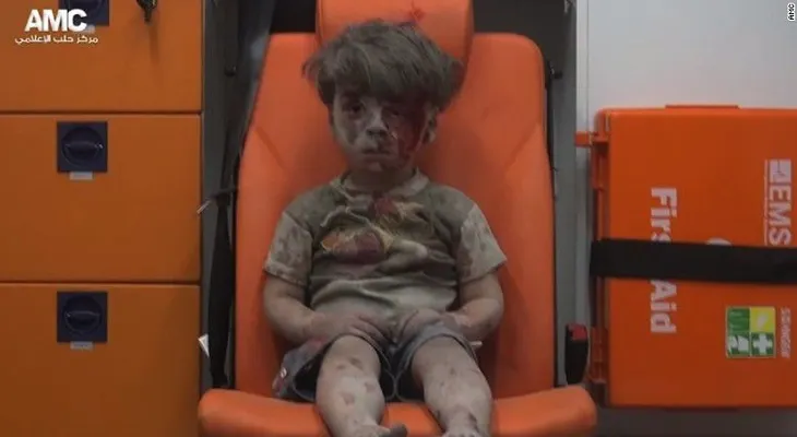 Muere el hermano del pequeñito que se volvió la imagen de las atrocidades de la guerra en Siria