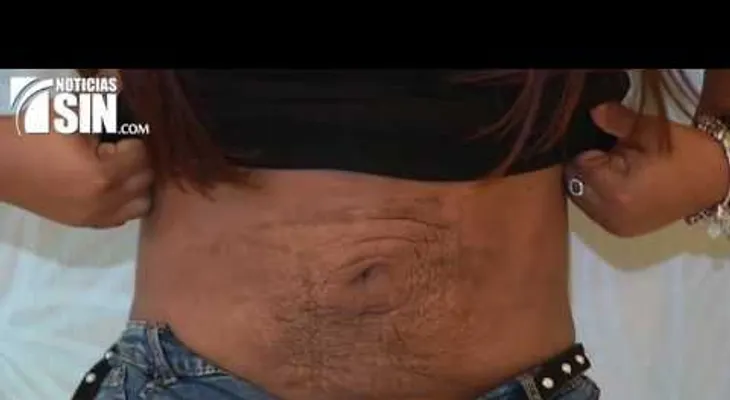 Centro de estética era el camino a la muerte: Así quedaron estas mujeres y un hombre