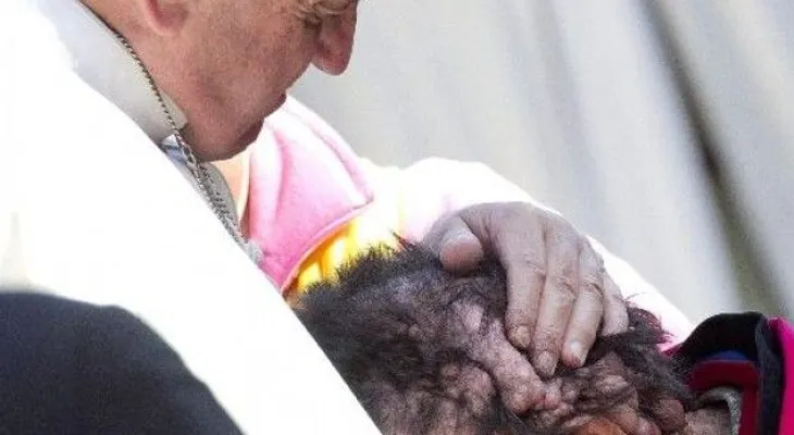 El Papa abraza hombre afectado de rara enfermedad