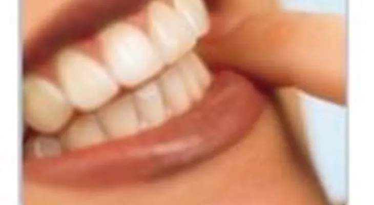 Desarrollan biomateriales dentales con nanopartículas 