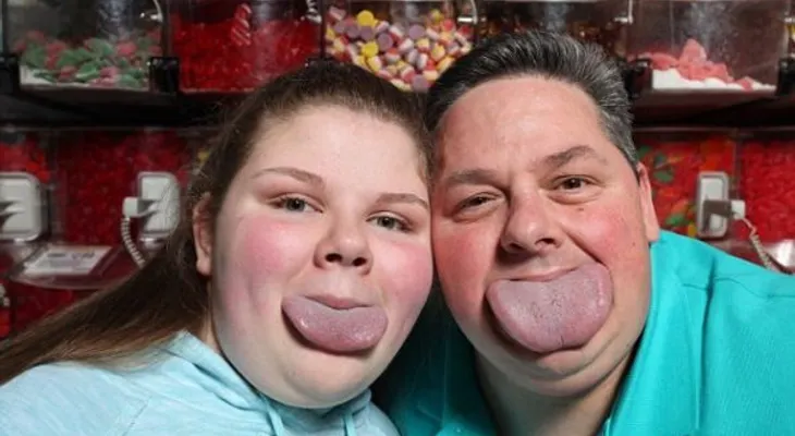 Con la lengua más ancha del mundo