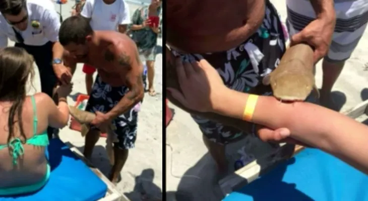 Mujer mordida por tiburón fue trasladada al hospital con el animal aún colgando de su brazo