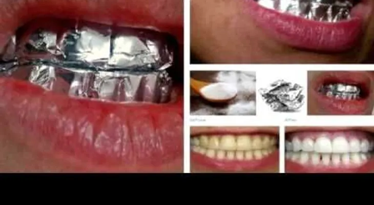 Blanquea tus dientes usando papel aluminio en 20 minutos