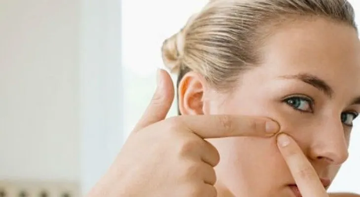 5 pasos para un rostro libre de acné